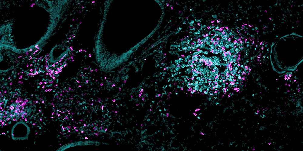 T-Gedächtniszellen und antikörperproduzierende B-Zellen im Lungengewebe einer Maus