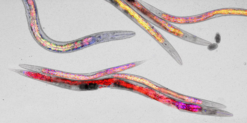 Longevity research:  Dietary stress supports healthy aging