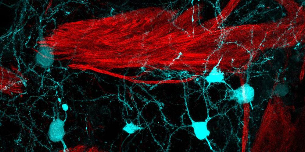 When a virus releases the immune brake: New evidence on the onset of multiple sclerosis