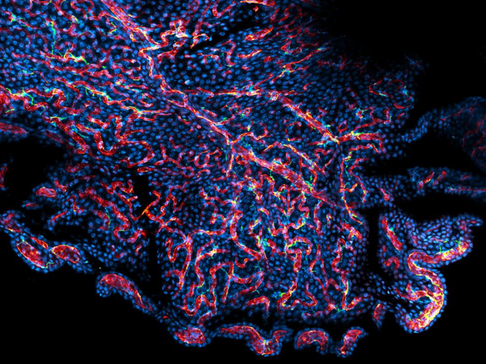 Mäusehirn, © Universität Basel, Imaging Facility / Labor Doetsch Mäusehirn, © Universität Basel, Imaging Facility / Labor Doetsch