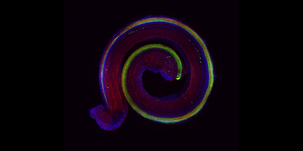 Fluorescence microscopic image of the cochlea