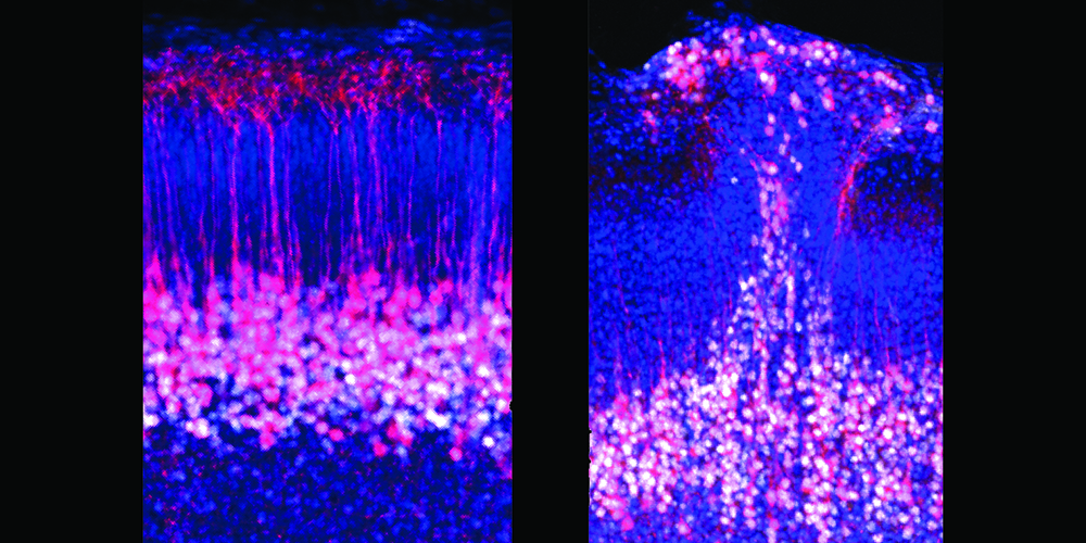 Pyramidal neurons in normal mice and mice with autism-like symptoms.