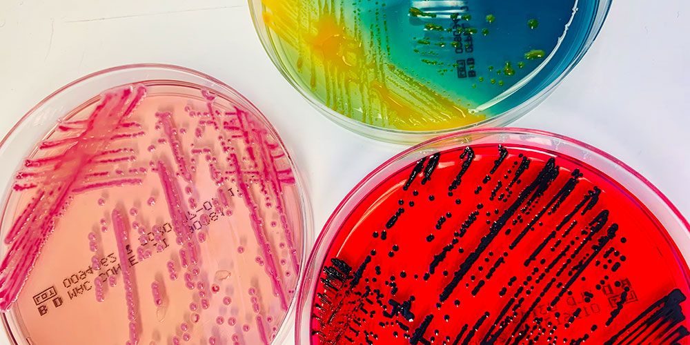 Über dreissig neue Bakterienarten in Patientenproben entdeckt