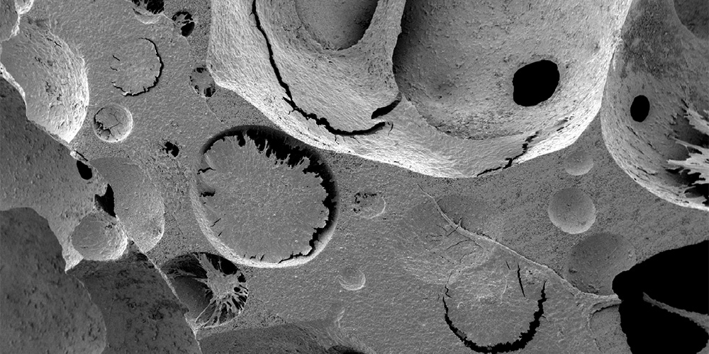 Blutbildung: Forscher bilden menschliches Knochenmarkgewebe nach