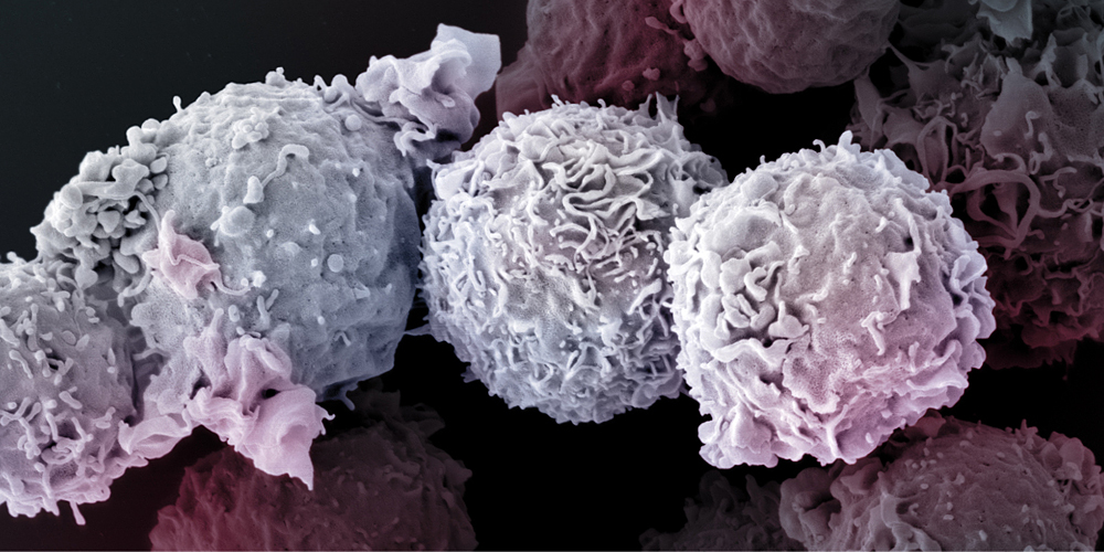 Elektronenmikroskopische Aufnahme von T-Zellen