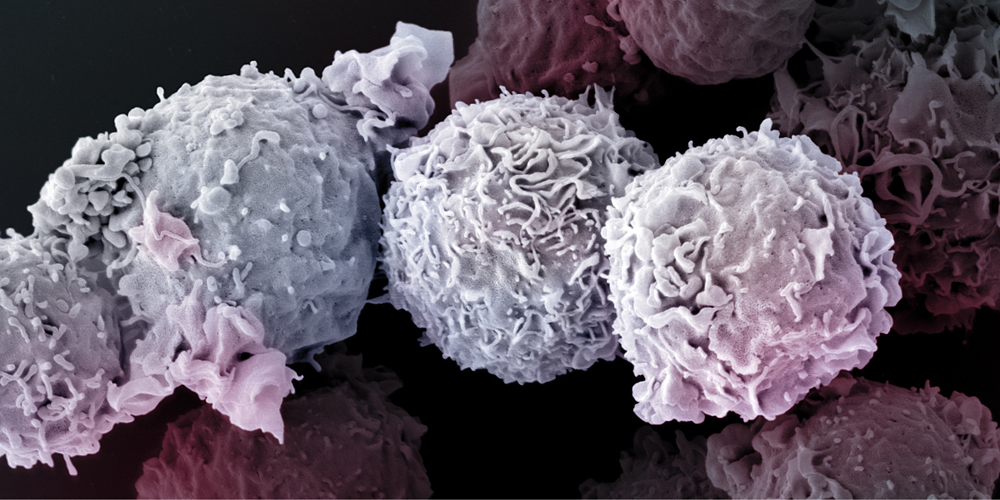 T cells: No time to die