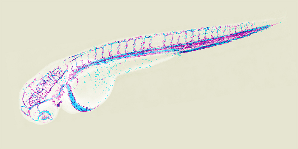Vascular system of a two days old zebrafish embryo (magenta: endothelial cells, light blue: blood cells). (Image: University of Basel, Biozentrum)