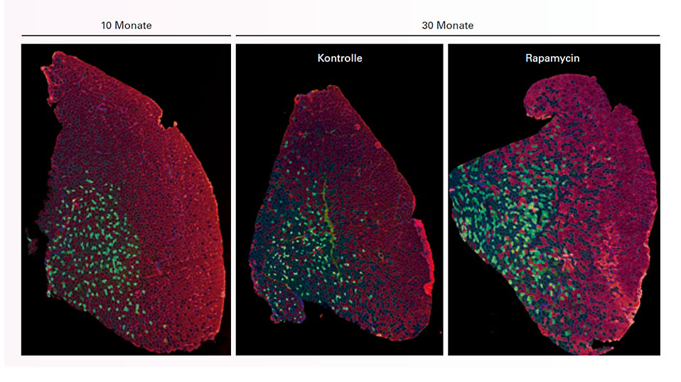 Combating muscular atrophy.