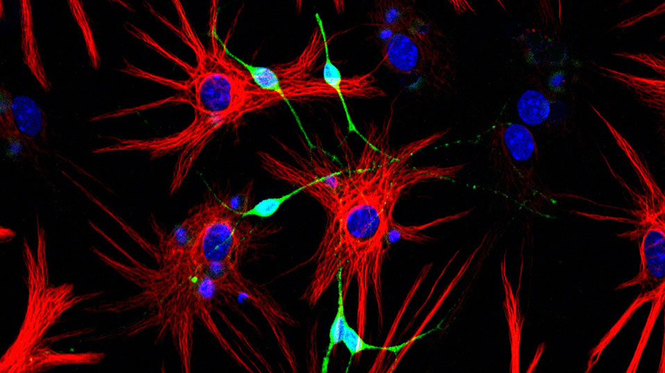 Star-shaped stem cells (red) give rise to new neurons (green). (Image: Fiona Doetsch, University of Basel, Biozentrum) Star-shaped stem cells (red) give rise to new neurons (green). (Image: Fiona Doetsch, University of Basel, Biozentrum)