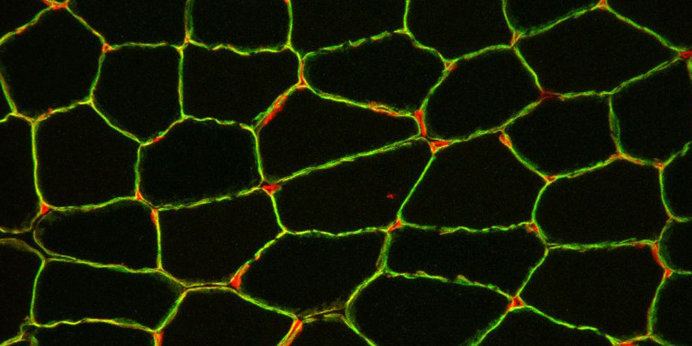 Cross section of a muscle biopsy: Blood vessels (red) between the muscle fibers and laminin-α2 (green), which surrounds each muscle fiber. 