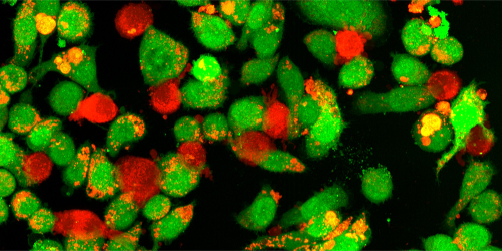 Neue Moleküle gegen hartnäckige Tumore