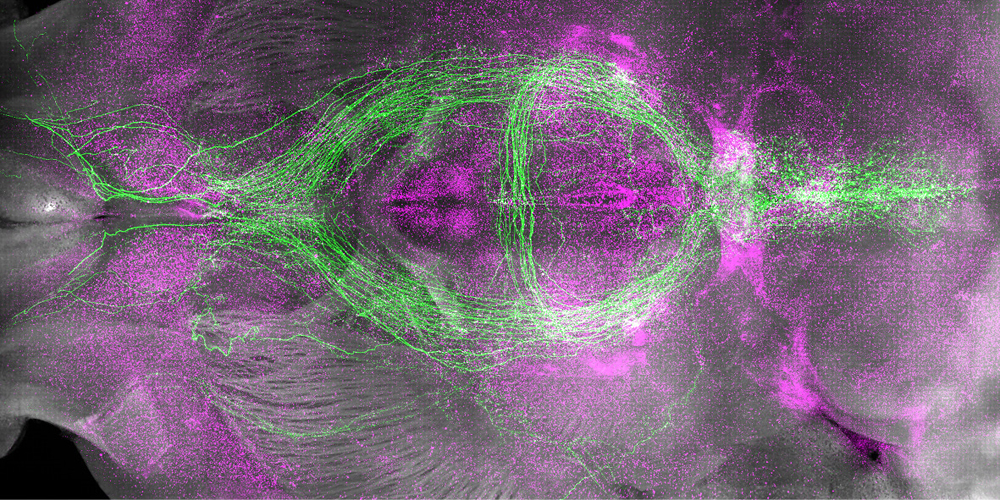 Why do we get sleepy? How neurons control sleep drive