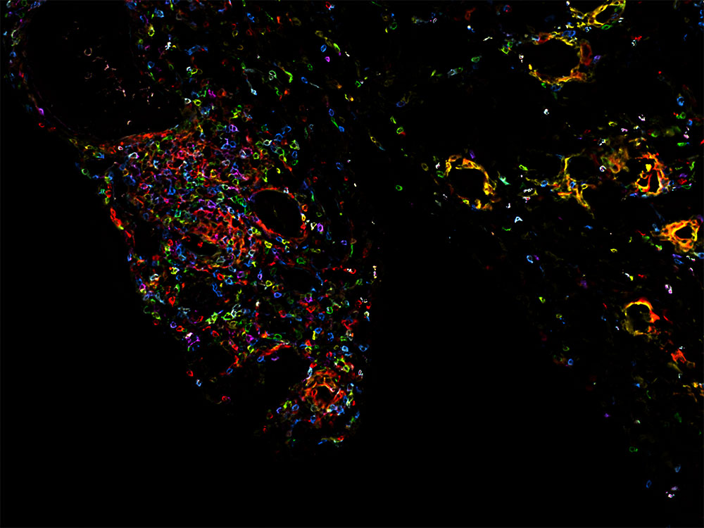 Visualisierung von aktivierten Immunzellen Visualisierung von aktivierten Immunzellen