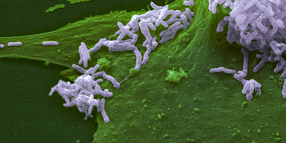 Toxin von Bakterien begünstigt chronische Infektion