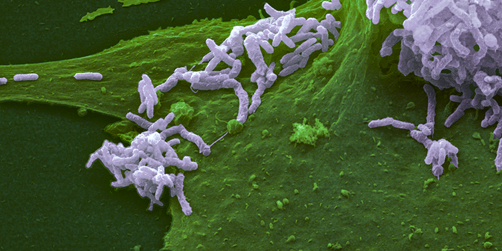 A bacterial toxin facilitating chronic infection