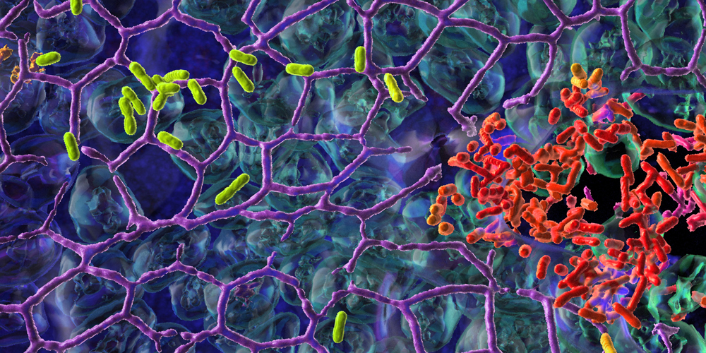 Der Spitalkeim Pseudomonas aeruginosa besiedelt die Schleimhaut der Lunge (blau), indem er zwei verschiedene Populationen bildet – dargestellt sind sesshafte und bewegliche Bakterien.
