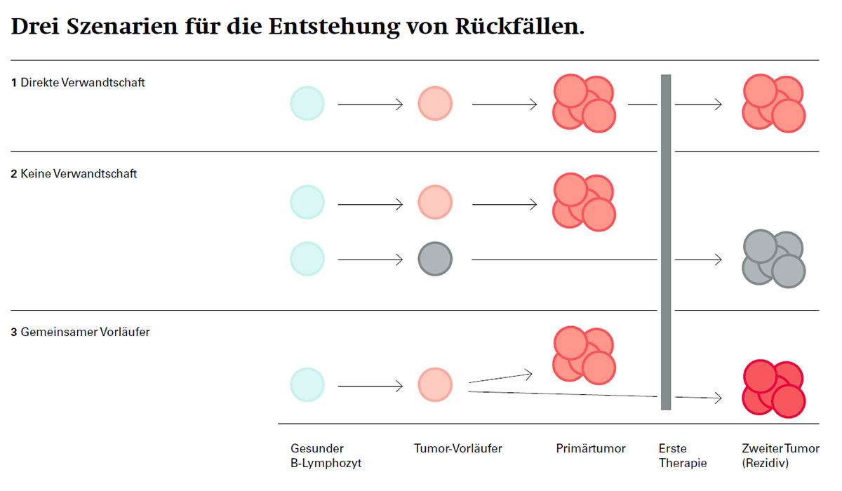 Bessere Therapie bei Rückfällen von Lymphkrebs