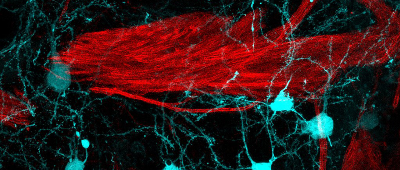 Fluoreszenzmikroskopische Aufnahme des Gehirns einer Maus mit Nervenzellen und Myelinschicht