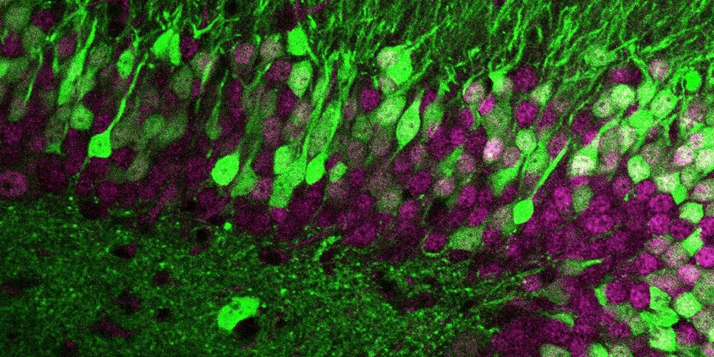 Unique fingerprint: What makes nerve cells unmistakable?