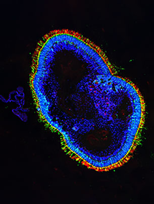 Fluoreszenzbild: Querschnitt durch ein Organoid. Zellkerne sind blau, die Stäbchen der Fotorezeptoren grün und die lichtempfindlichen Antennen der Fotorezeptoren sind rot. (Bild: IOB)