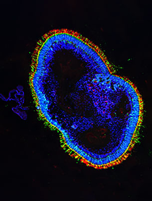 New retinal tissue from skin samples.