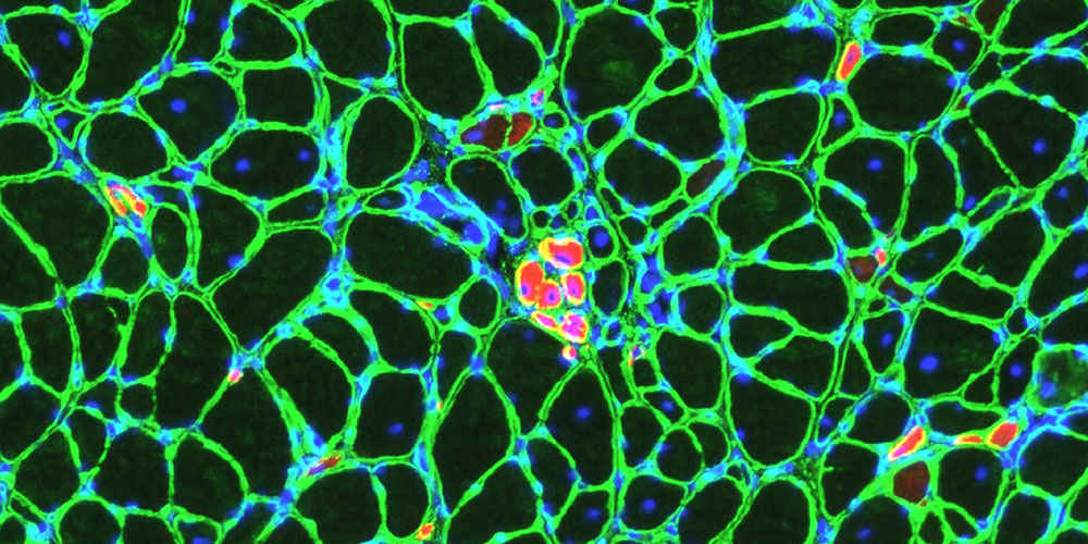 Cross-section through treated LAMA2 MD muscle with individual muscle fibers surrounded by laminin (green) and regenerated small muscle fibers (red). (Image: University of Basel, Biozentrum)