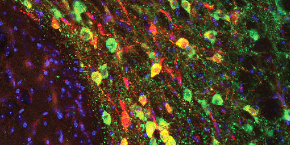 Picture of Dopamine neurons involved in social interaction. (Image: University of Geneva)