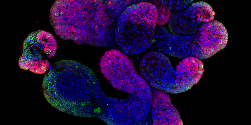 Miniature organs shed light on intestinal regeneration