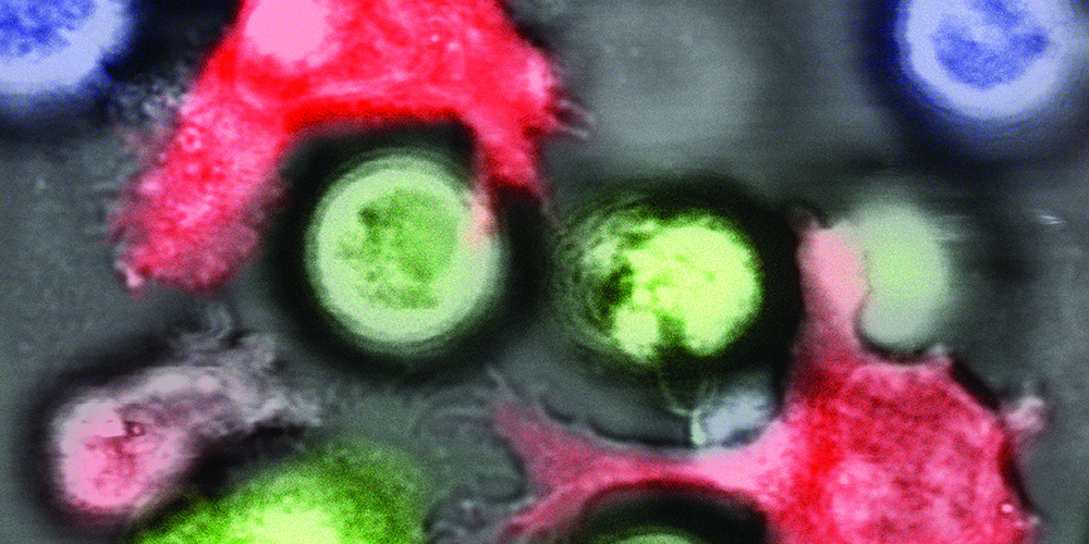 Natürliche Killerzellen (rot) greifen gewöhnliche Leukämiezellen (grün), aber nicht Leukämie-Stammzellen (blau) an. Dies weil letztere durch stammzellspezifische Mechanismen die Expression wichtiger Erkennungsmerkmale (NKG2D-Liganden) an der Zelloberfläche unterdrücken. (Bild: Universität Basel, Departement Biomedizin, Christoph Schürch)