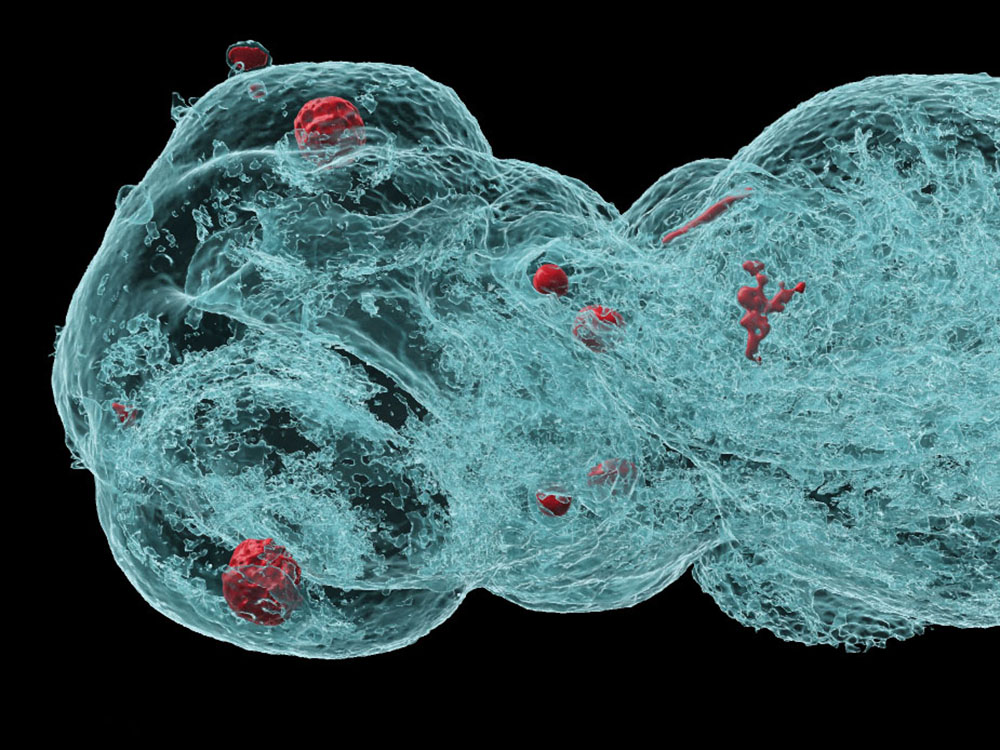 Mikrotomografische Aufnahme der Kopfpartie eines Zebrafisch-Embryos Mikrotomografische Aufnahme der Kopfpartie eines Zebrafisch-Embryos