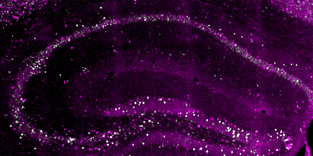 The brain creates three copies for a single memory