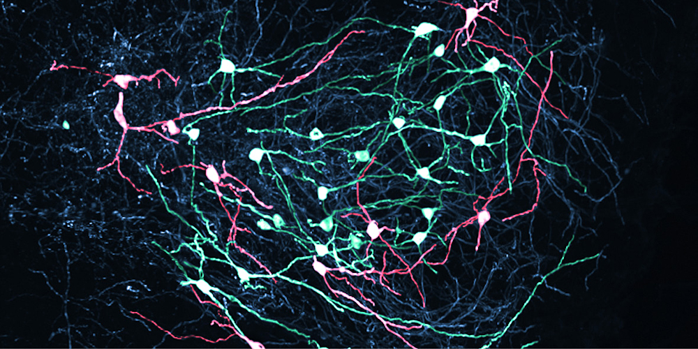 A switchboard with precision: How the brain licenses movements