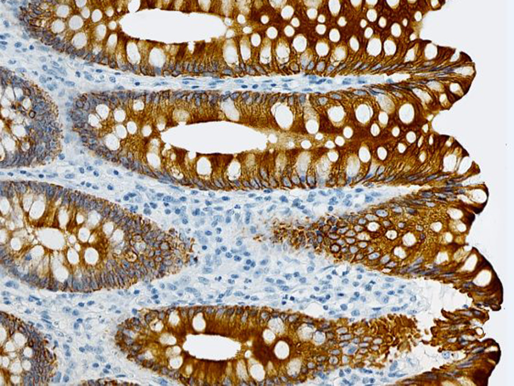 Immunhistochemie am menschlichen Darm, © Universität Basel, Histologie Core Facility Immunhistochemie am menschlichen Darm, © Universität Basel, Histologie Core Facility