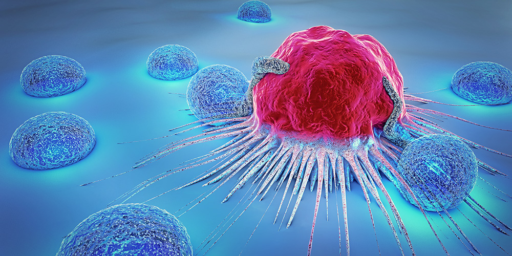 Researchers identify how to prevent cancer metastases