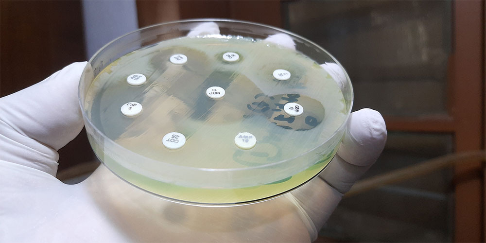 Antibiogramm von Bakterien in einem Nährmedium