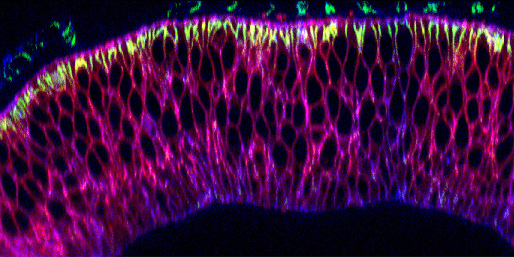 Relocation of Proteins with a New Nanobody Tool