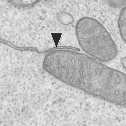 Beispiel einer Verbindung zwischen einem Mitochondrium und dem endoplasmatischen Retikulum. Diese Verbindungen ermöglichen es den CD8-Gedächtniszellen, uns rasch vor Infektionen zu schützen. Beispiel einer Verbindung zwischen einem Mitochondrium und dem endoplasmatischen Retikulum. Diese Verbindungen ermöglichen es den CD8-Gedächtniszellen, uns rasch vor Infektionen zu schützen.