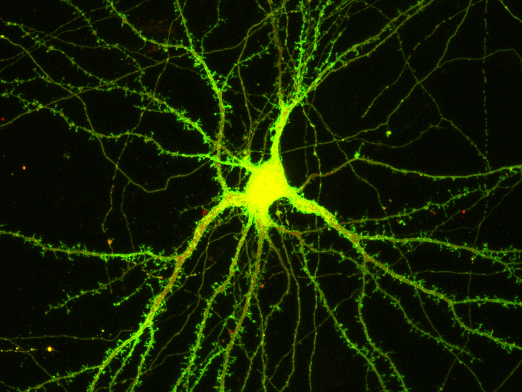 Kultivierte Nervenzelle (rot). Nach Stimulation hat sich Copine-6 (grün) an den zahlreichen Synapsen der Empfängerzelle angereichert.
